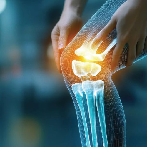 Orthopedics